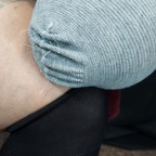 Onlyfans leaked notoesnoleftleg 

 profile picture